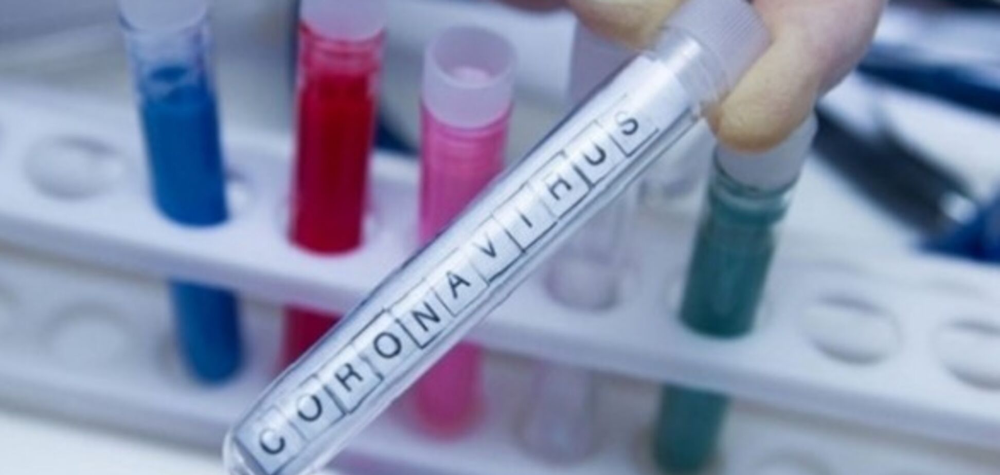 На Буковине за сутки добавилось 30 случаев коронавируса