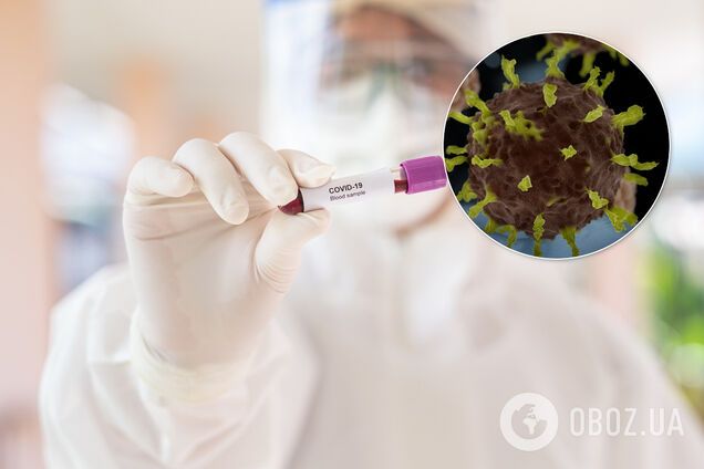В Україні намітилася позитивна тенденція із коронавірусом: лікарка зауважила оптимістичну деталь