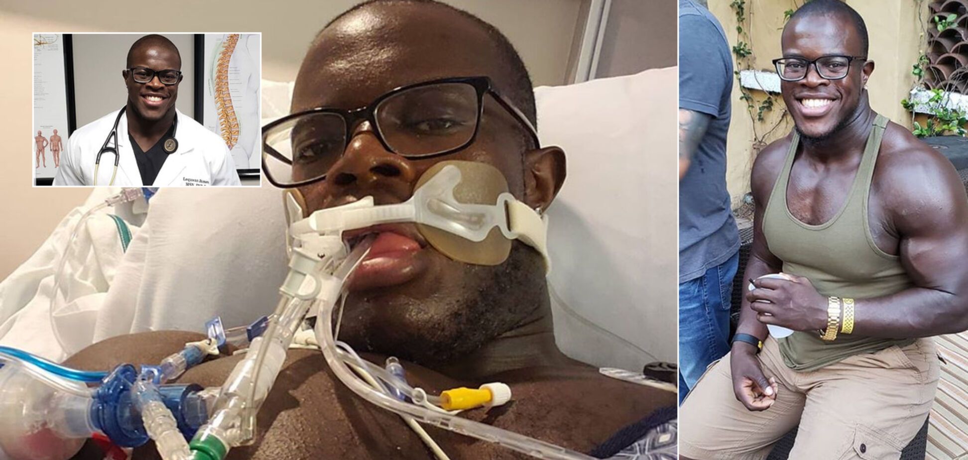 Бодібілдер, що перехворiв на коронавiрус, описав симптоми і звернувся із закликом