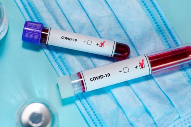 Як пройти тест на коронавірус за відмови лікаря: МОЗ дало інструкцію