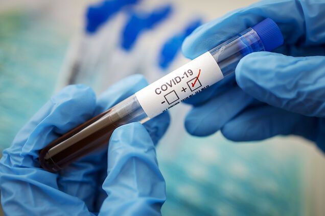 +17 за добу: на Дніпропетровщині збільшилася кількість заражених коронавірусом