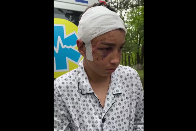 Били лопатой и пилой: 17-летний парень из Харькова раскрыл новые детали о пытках