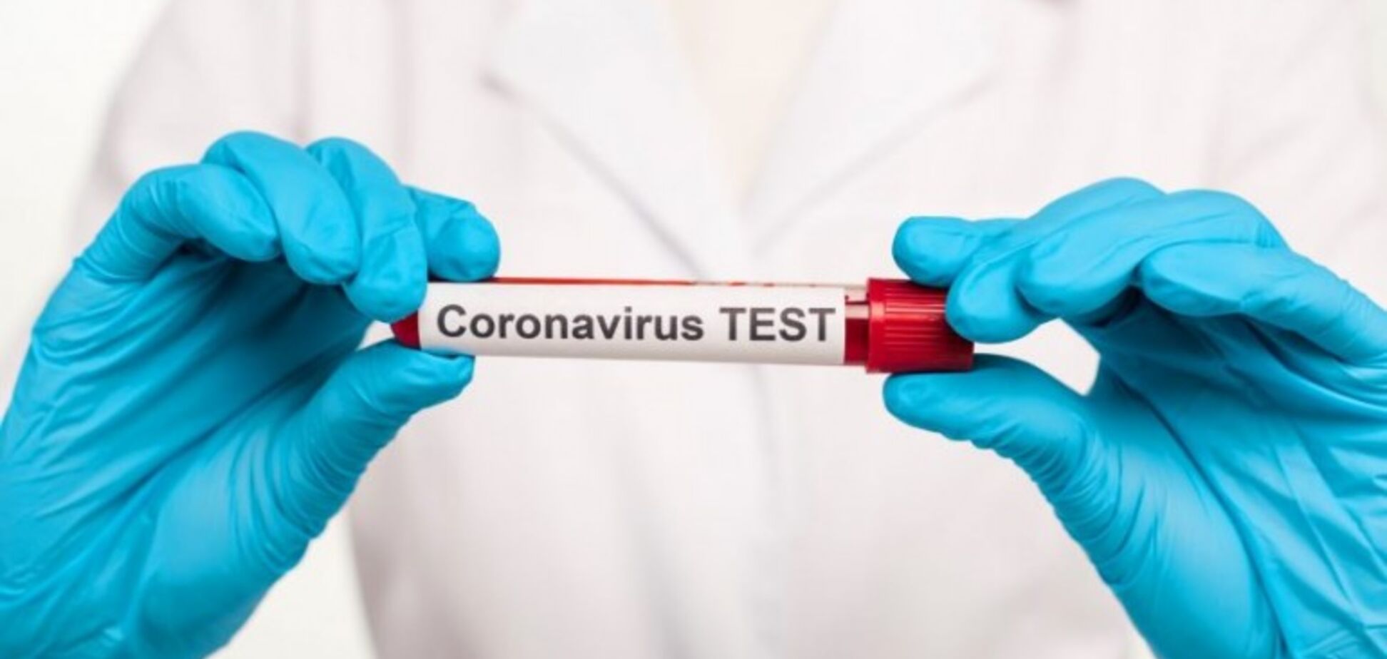 Тест на коронавірус 