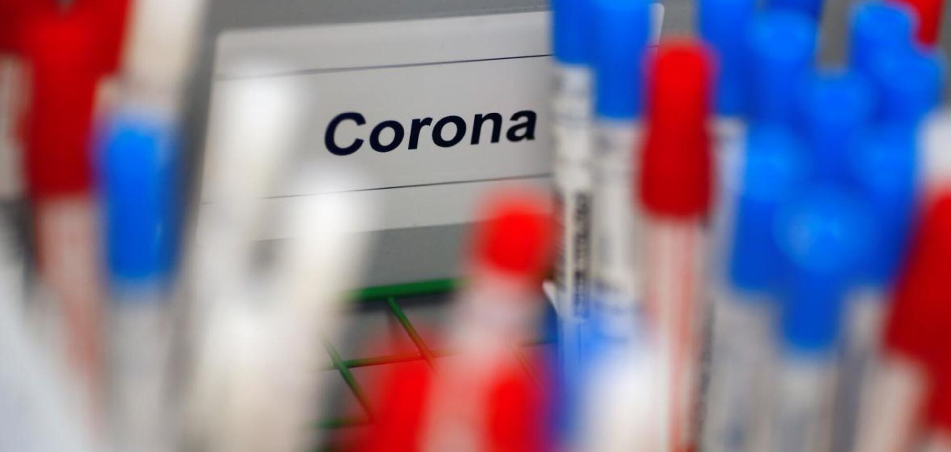 Происхождение коронавируса: единственная версия на сегодня