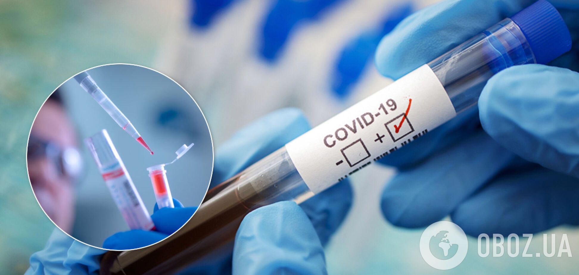 В 'Укргентеху' виправдалися за скандал із 'китайськими' тестами на коронавірус