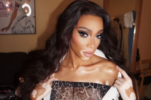 Модель с неизлечимой болезнью кожи Винни Харлоу восхитила пикантными фото в бикини