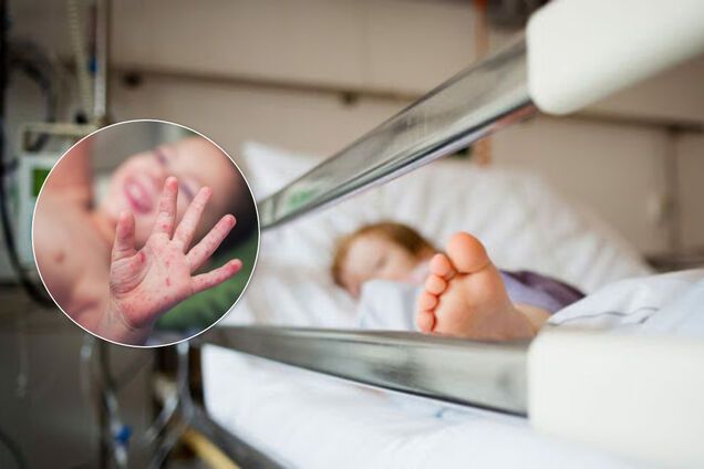 Рвота, лихорадка и сыпь: врачи рассказали о симптомах загадочной детской болезни, появившейся на фоне COVID-19