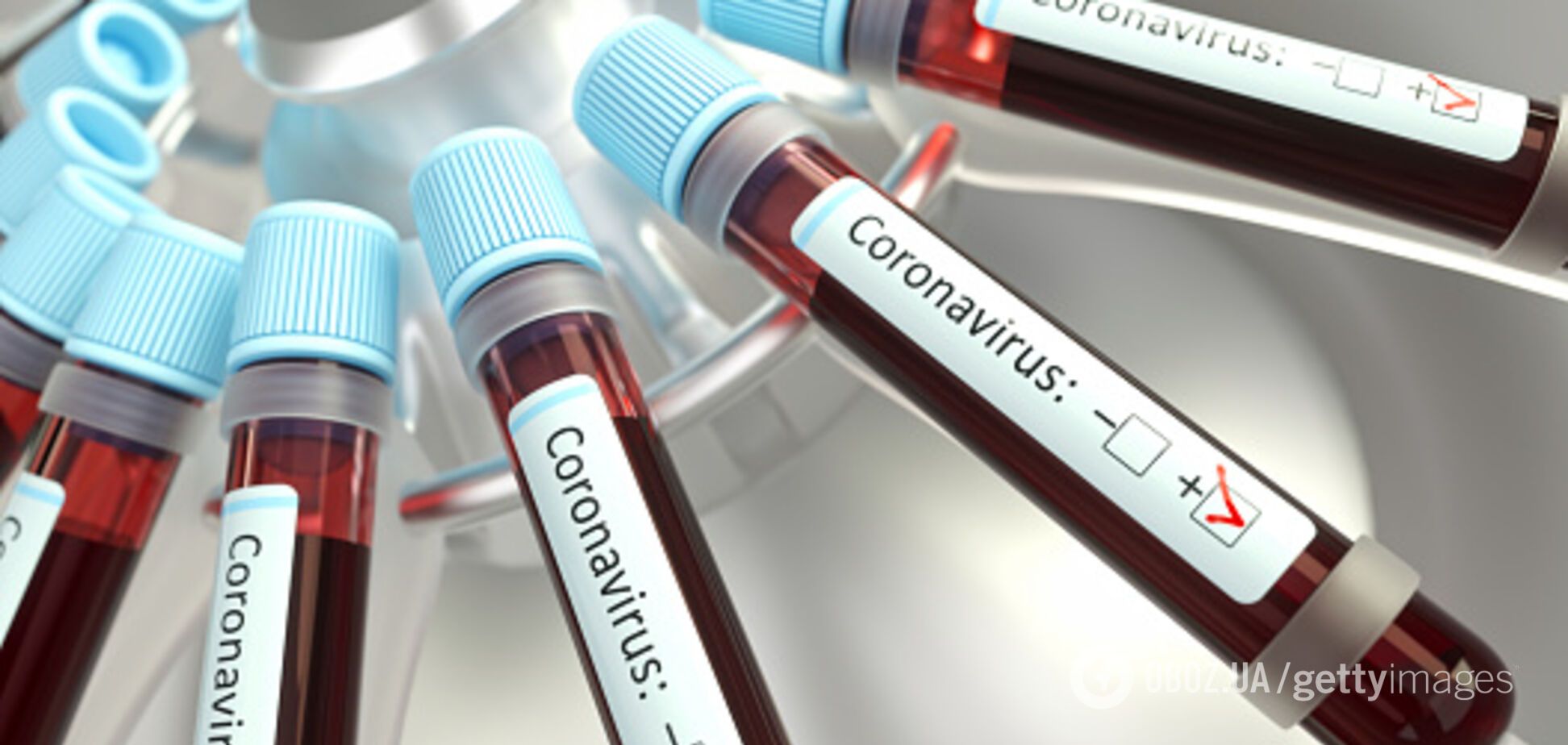 В Днепропетровской области впервые не зафиксировали новые случаи COVID-19