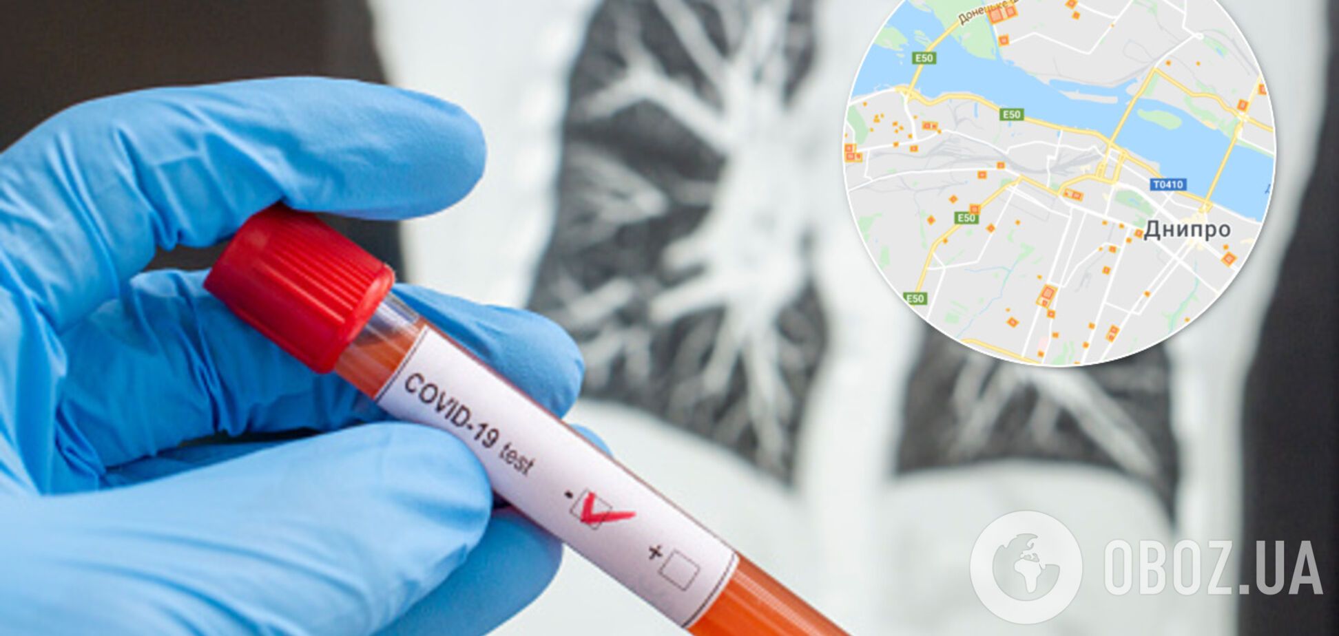 Коронавирусом в Днепре заразилось почти 350 человек: карта распространения COVID-19