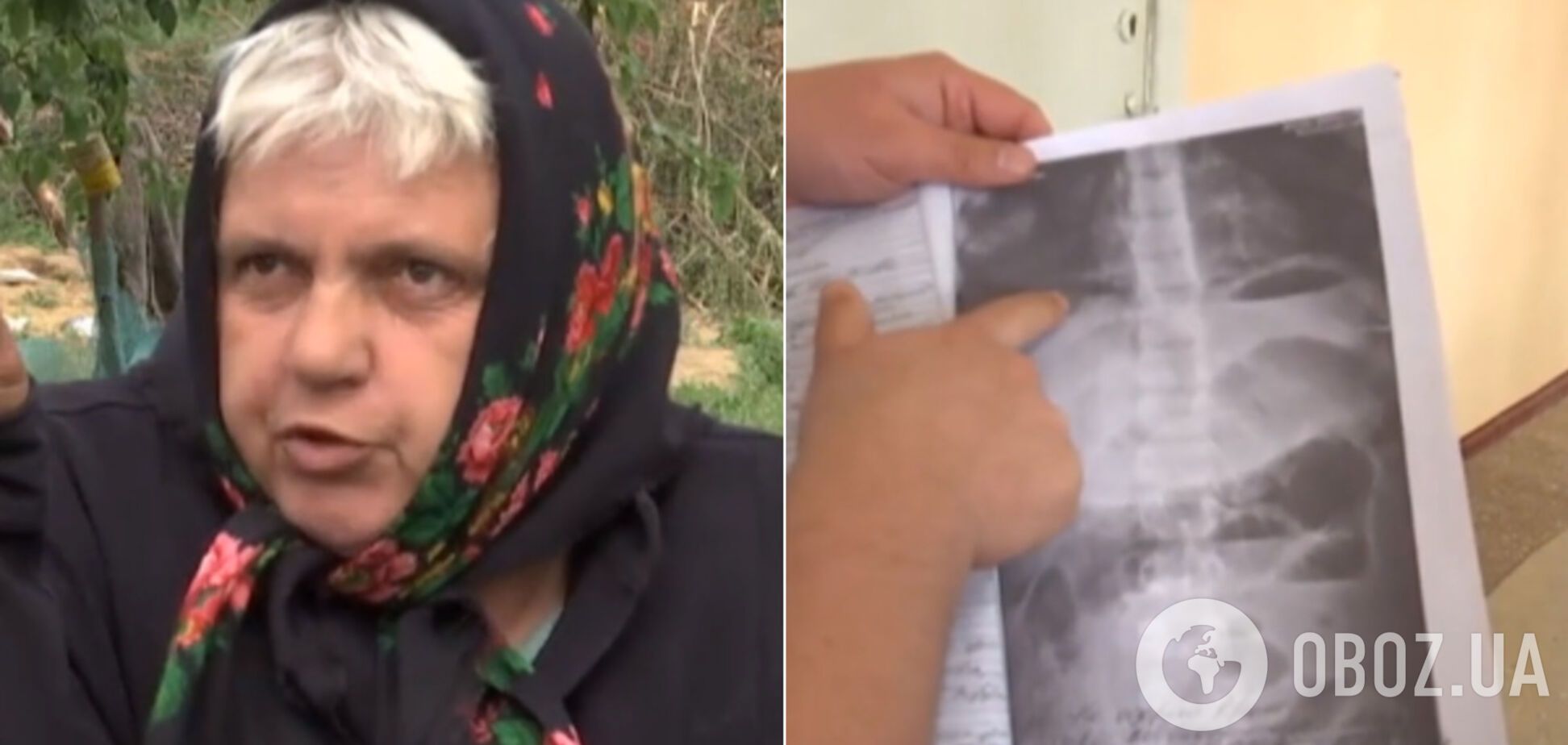 Наковтався гайок, болтів, саморізів: під Одесою померла дитина, яку лікувала знахарка