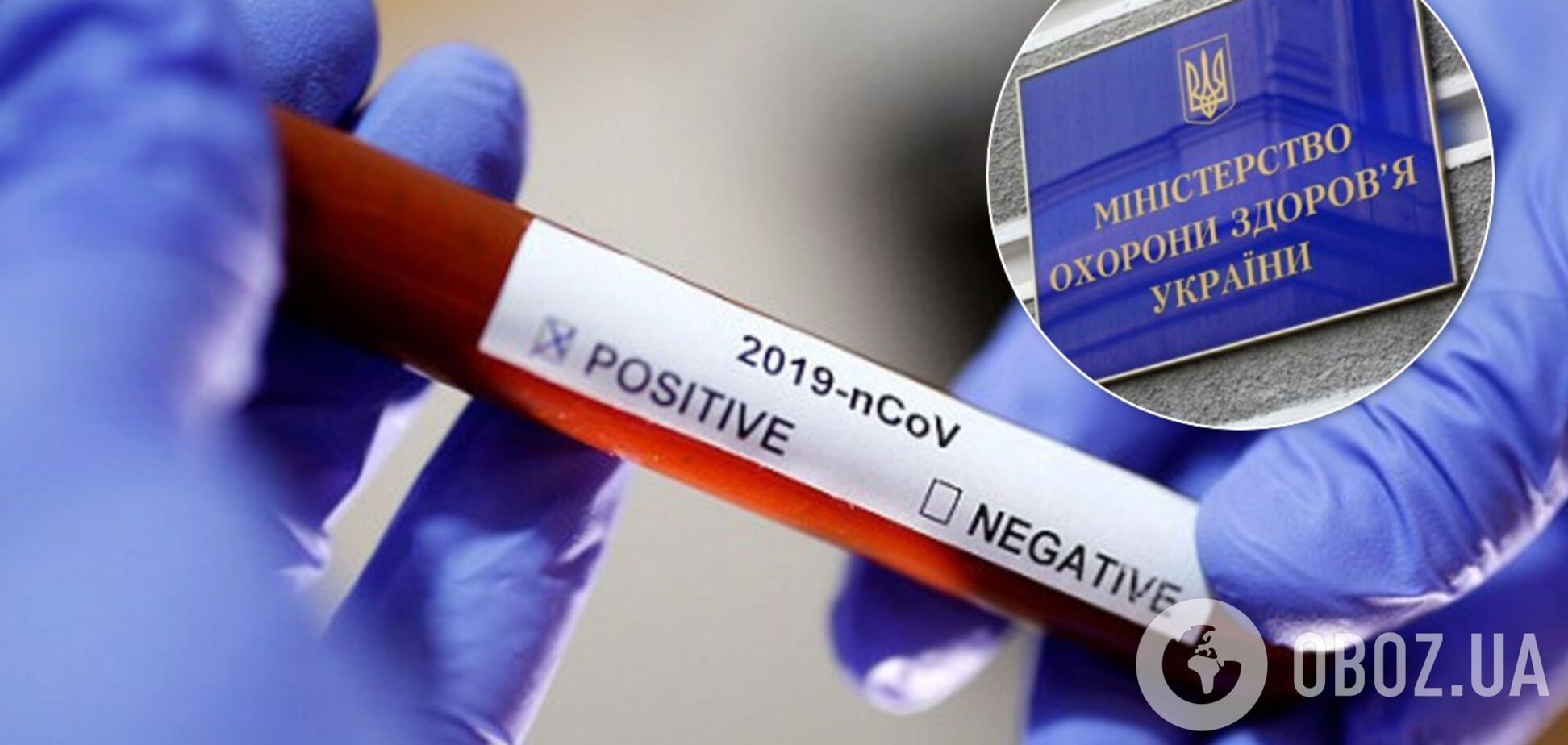 В Украине официально ввели ИФА-тестирование на антитела к COVID-19