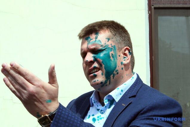 У Харкові скандальному депутату "ОПЗЖ" плеснули зеленкою в обличчя. Фото