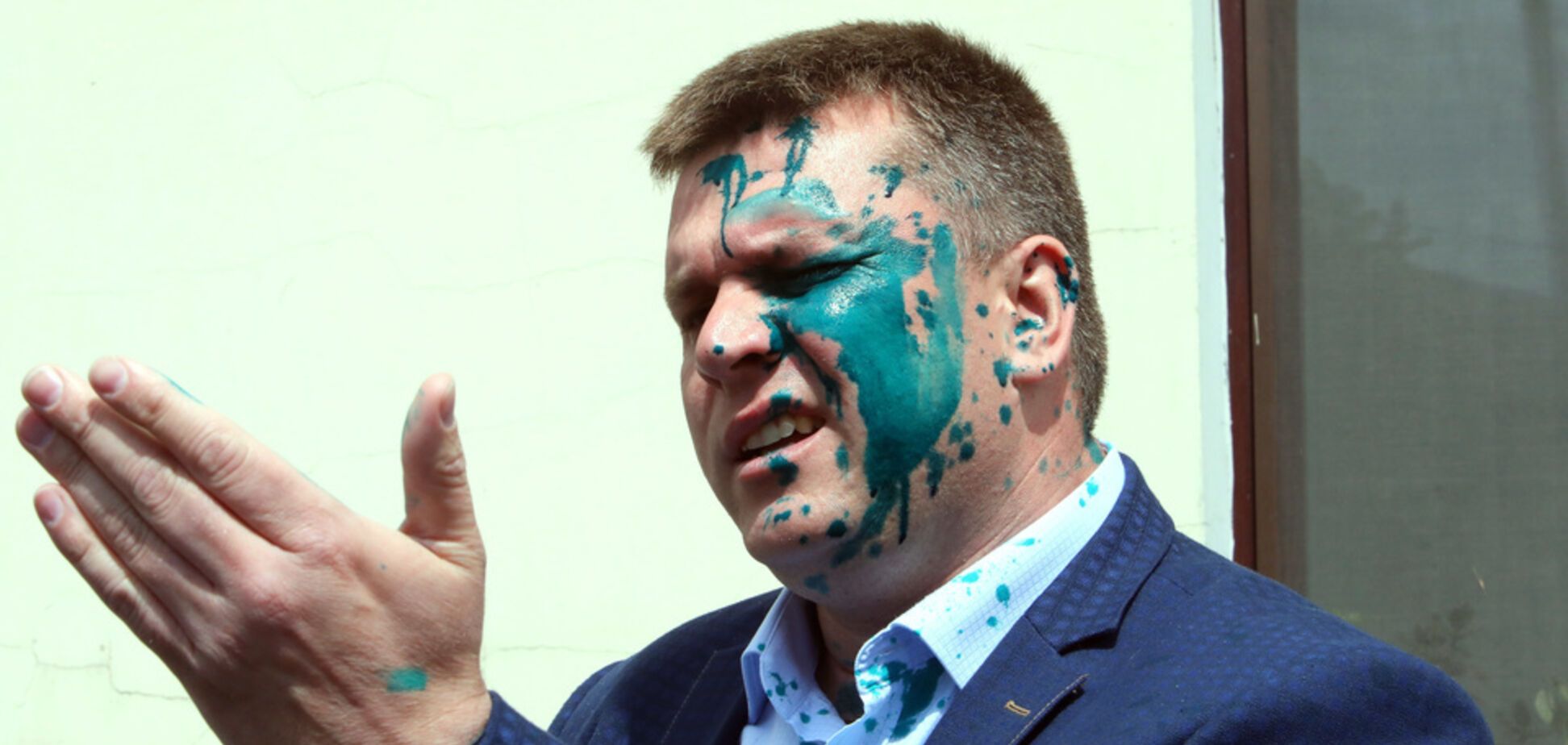 У Харкові скандальному депутату 'ОПЗЖ' плеснули зеленкою в обличчя. Фото