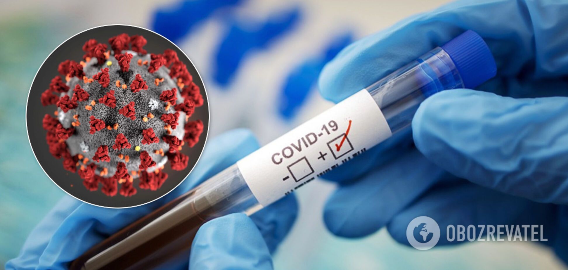 Названа хвороба, яка підвищує ризик смерті від коронавірусу