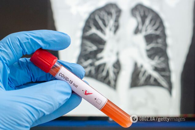 В Китае впервые не выявили новых зараженных: статистика по коронавирусу на 23 мая. Постоянно обновляется