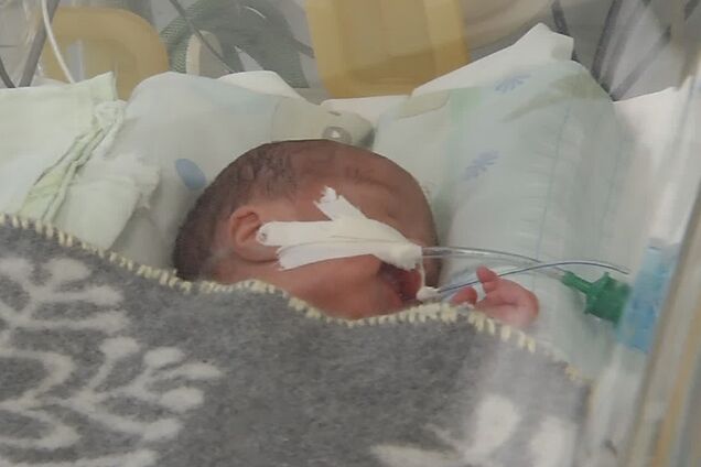 У Дніпрі батьки кинули в лікарні малюка з пороком серця: потрібна допомога