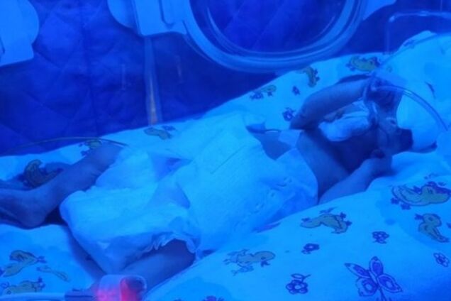 В Запорожье 16-летняя девушка родила ребенка весом менее 700 грамм: врачи борются за его спасение