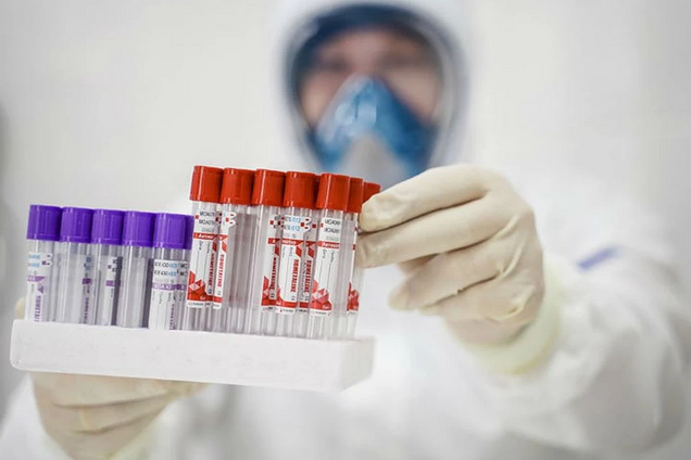 В Украине начали делать ИФА-тесты на коронавирус: кто попал в первую волну