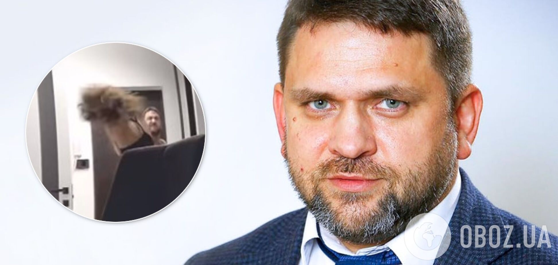 Топ-менеджера 'Укрзалізниці' обвинили в избиении сожительницы: он уволен. Фото и видео 18+