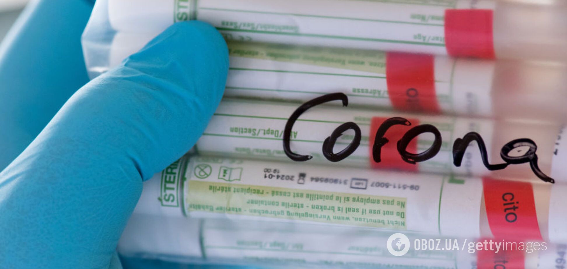 Скандал с тестами на COVID-19 в Днепре: в Минздраве отреагировали