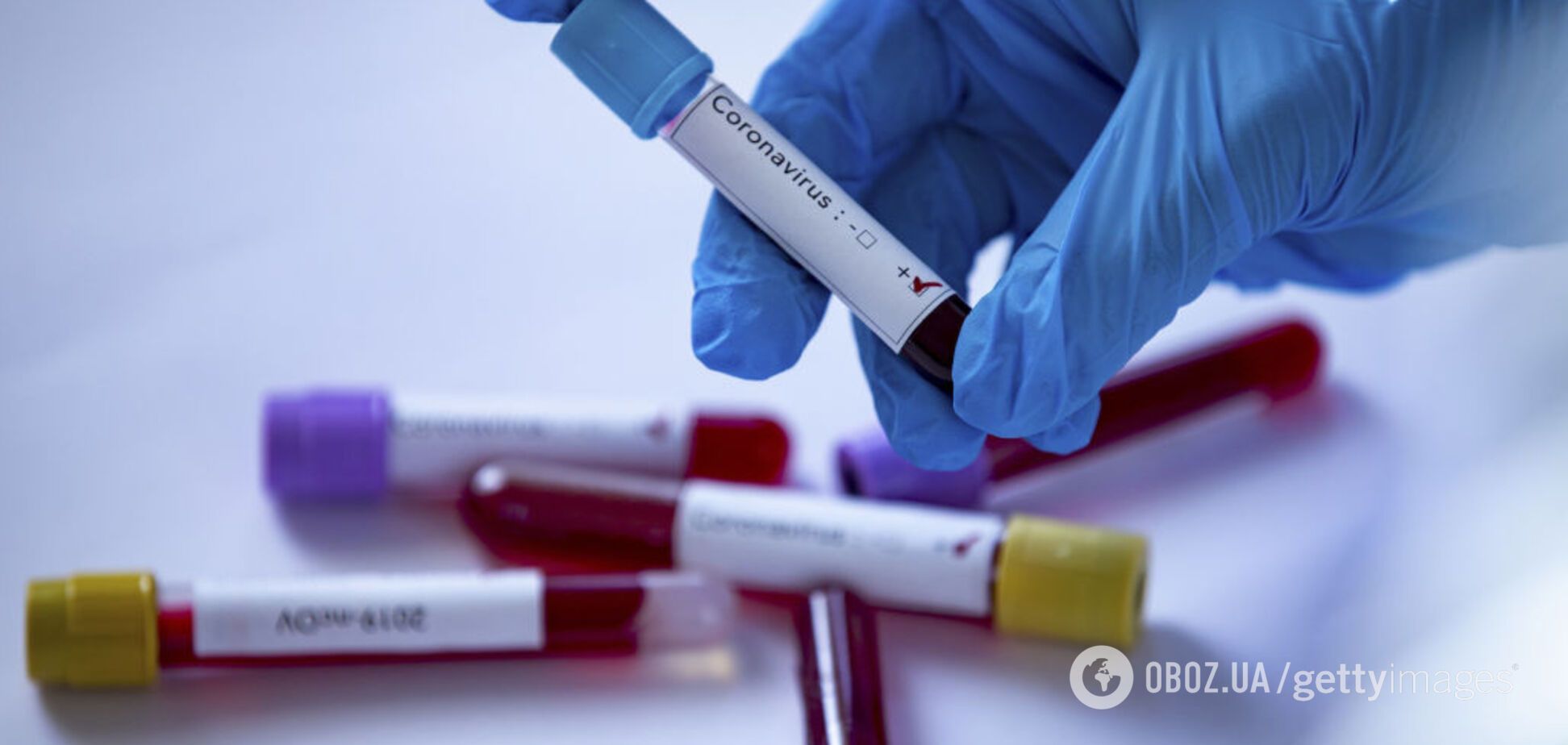Вирусолог оценила коллективный иммунитет украинцев и действенность тестов ИФА
