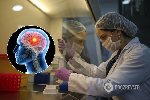Знайдено препарат проти смертельної пухлини мозку: підвищує виживання