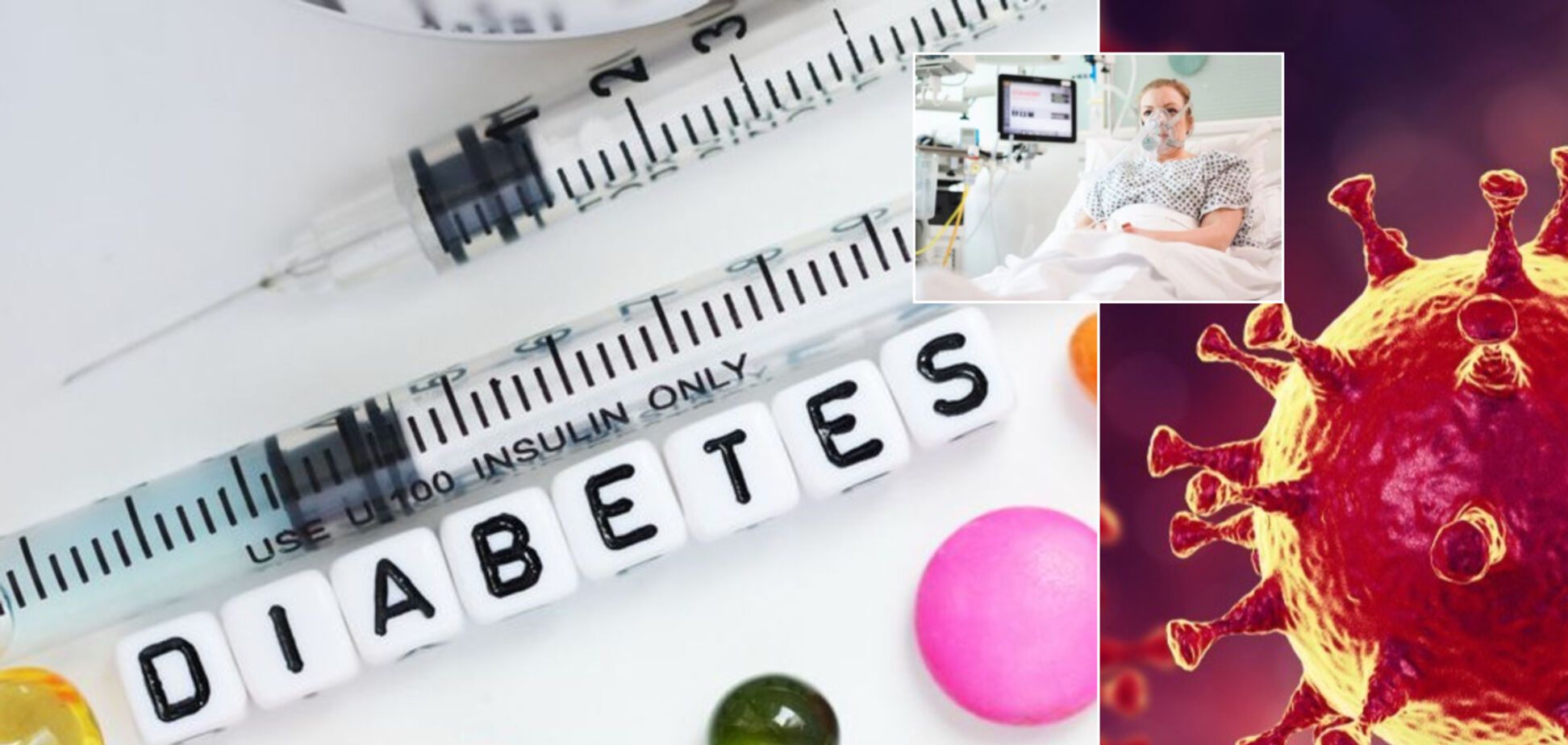 Вмирають до кінця другого тижня: вчені з Франції назвали групу ризику при захворюванні COVID-19