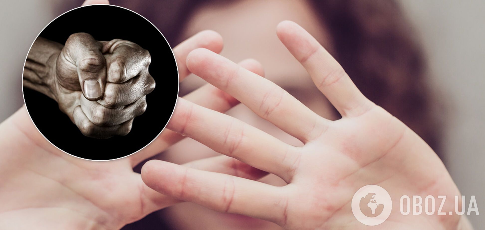 У Запоріжжі топчиновника звинуватили у побитті жінки. Ексклюзивні подробиці