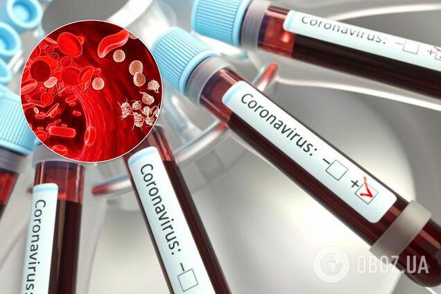 Лікар заявив про небезпечні зміни в крові при COVID-19