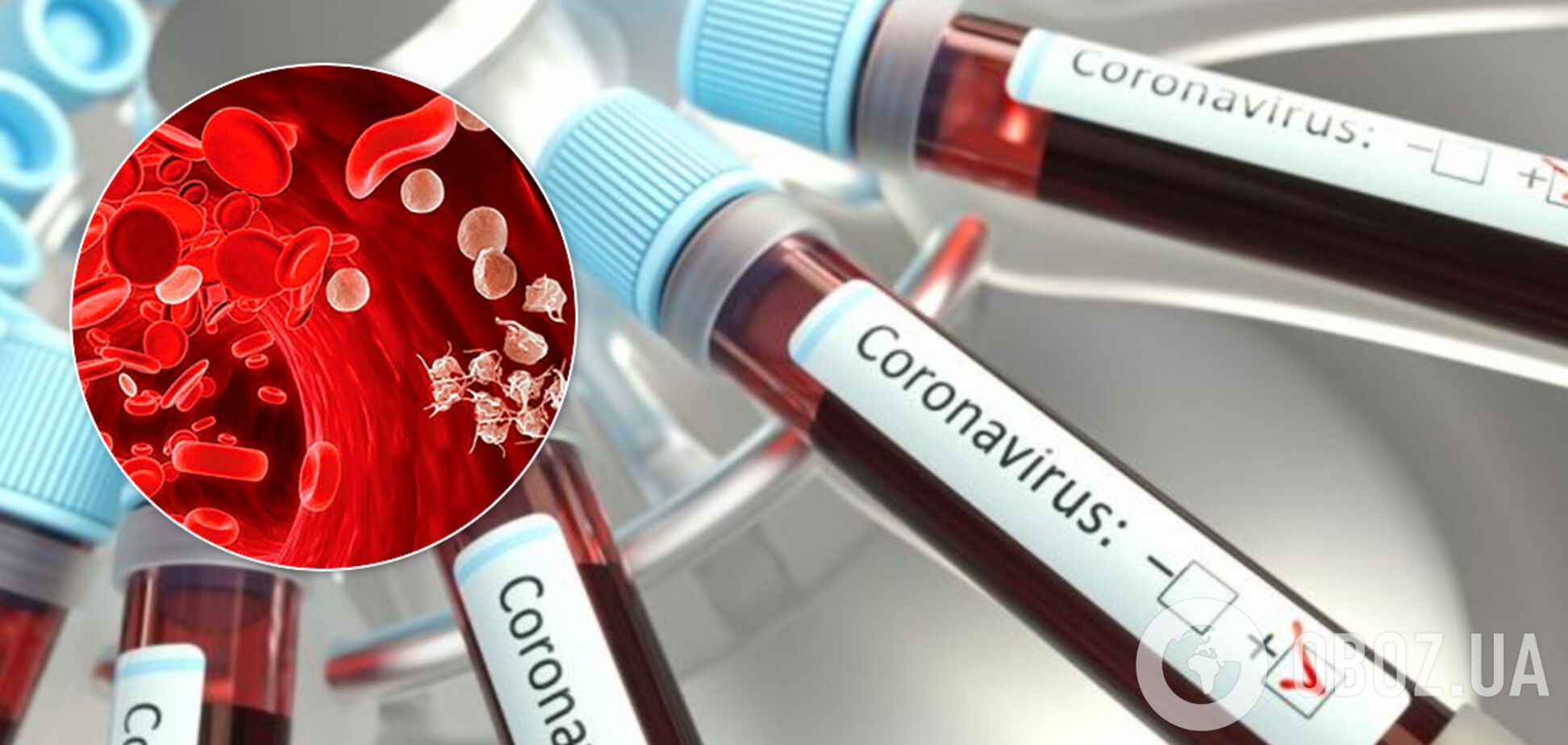 Врач заявил об опасных изменениях в крови при COVID-19