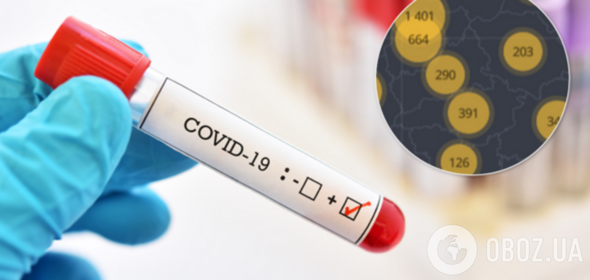 Плюс 502 за добу: з'явилася статистика МОЗ щодо коронавірусу на 3 травня