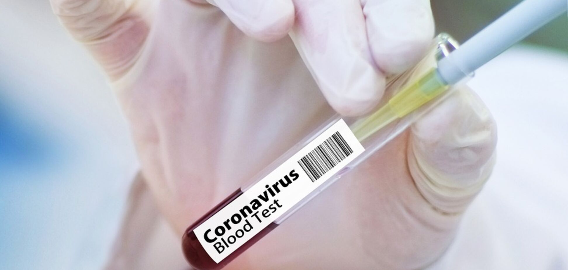 Названа патологія, яка призводить до смерті при коронавірусі