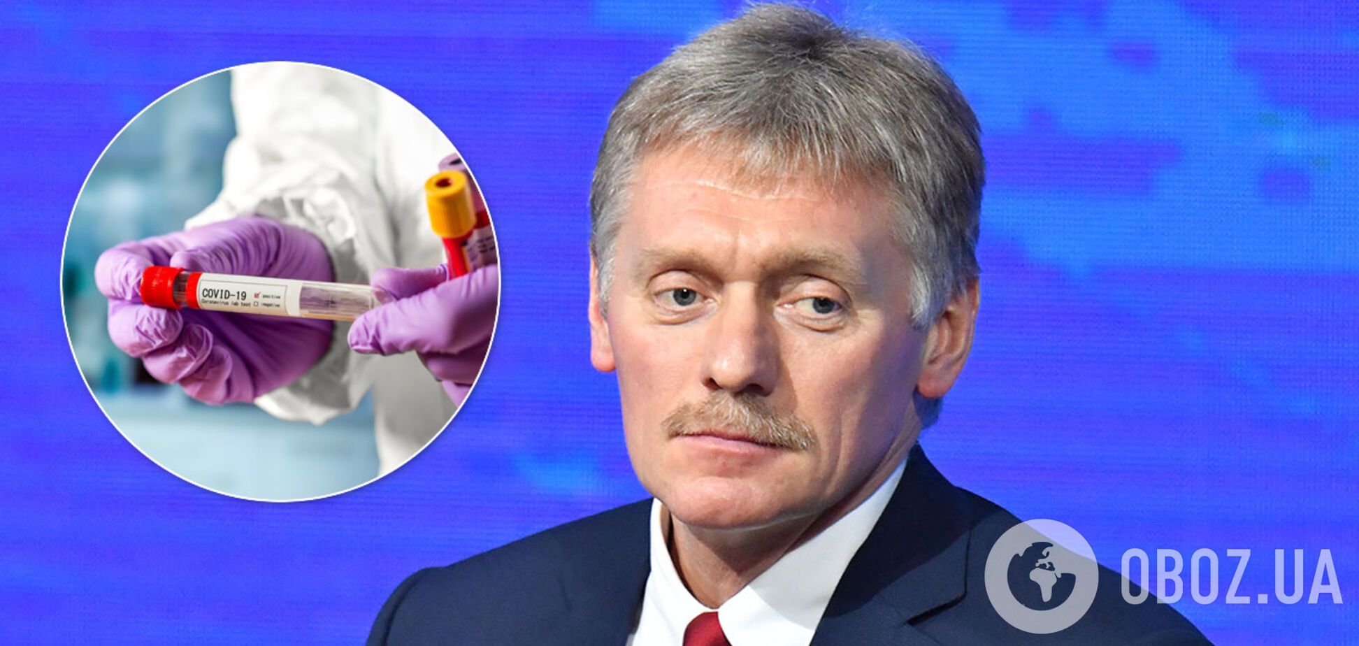 Песков рассказал о коронавирусе. Иллюстрация