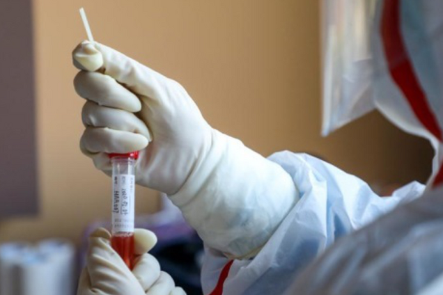 На Днепропетровщине обнаружили 9 новых больных коронавирусом: один человек умер