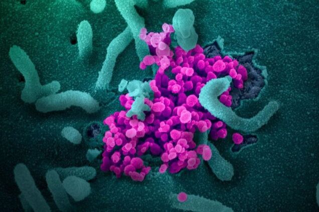 Коронавірус розмножується в кишечнику людини: підтвердився ще один спосіб передання