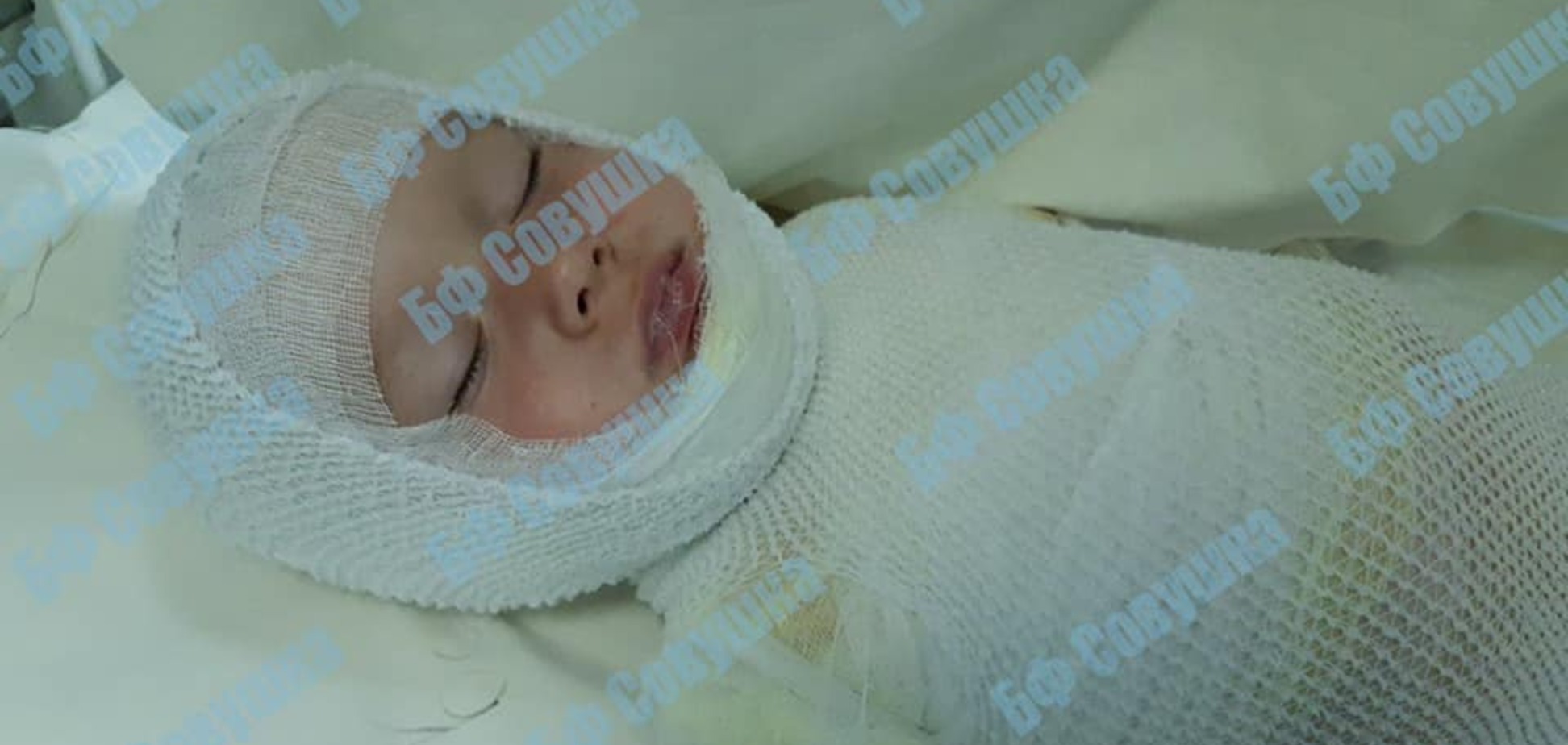 У Дніпрі 2-річна дитина перекинула на себе окріп: хлопчик в реанімації