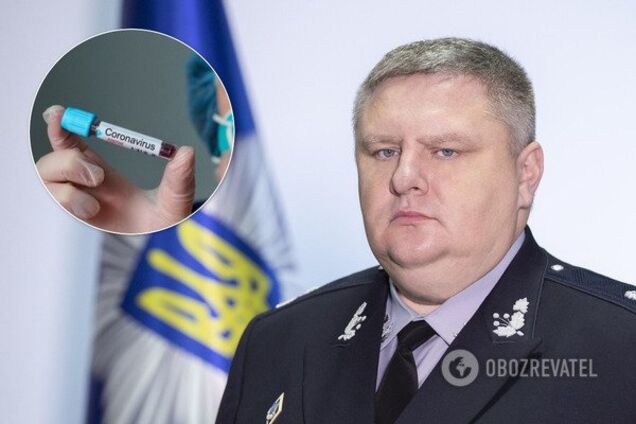 Начальник полиции Киева выздоровел от коронавируса