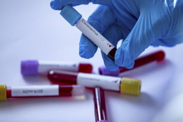 Дніпропетровщина побила антирекорд із коронавірусу: майже 100 випадків за день