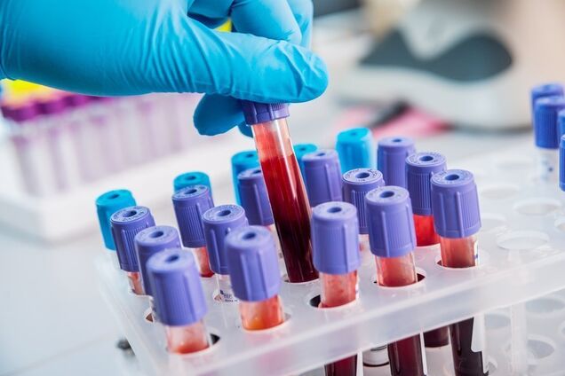 У Дніпрі почнуть збір плазми крові для ліків від COVID-19: скільки заплатять донорам