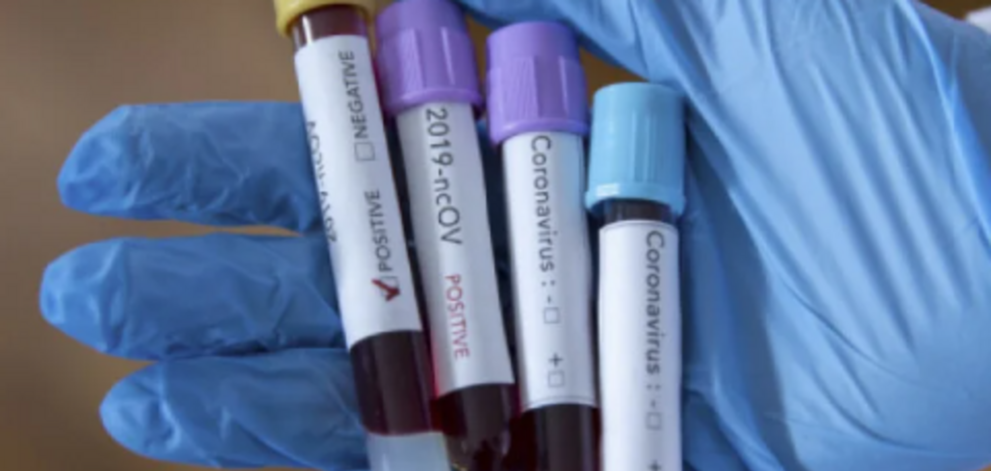 На Закарпатті коронавірус спалахнув у інтернаті