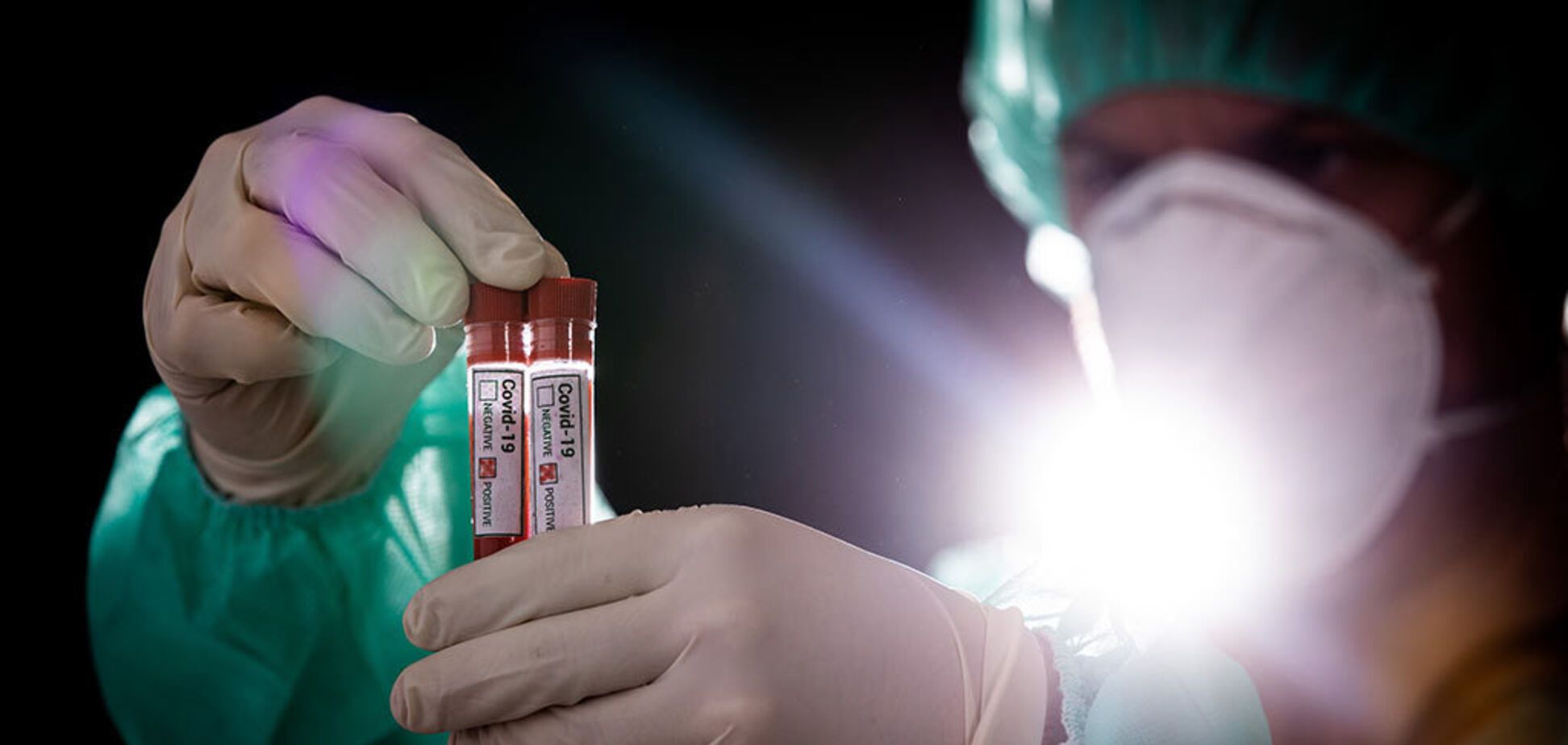 В украинском футболе зафиксирован первый случай коронавируса