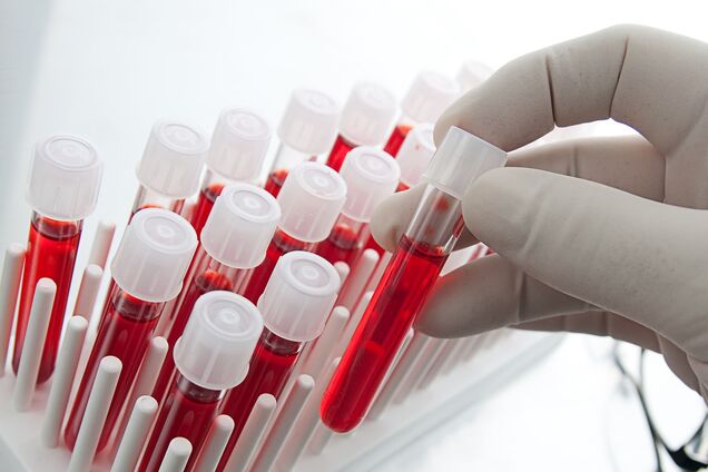 Новий золотий стандарт: британські вчені зробили прорив у діагностиці та відстеженні раку