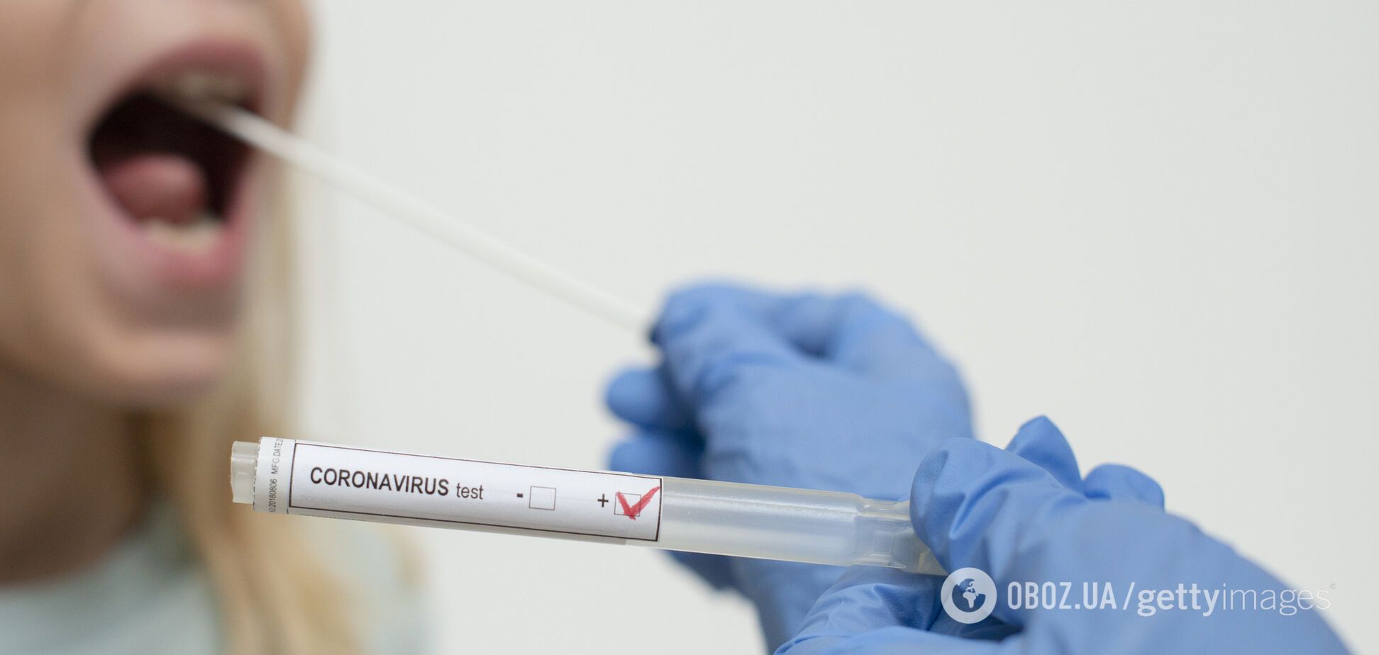 Коронавірус