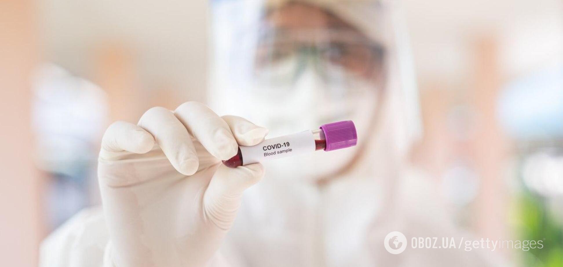 Коронавірус в Україні