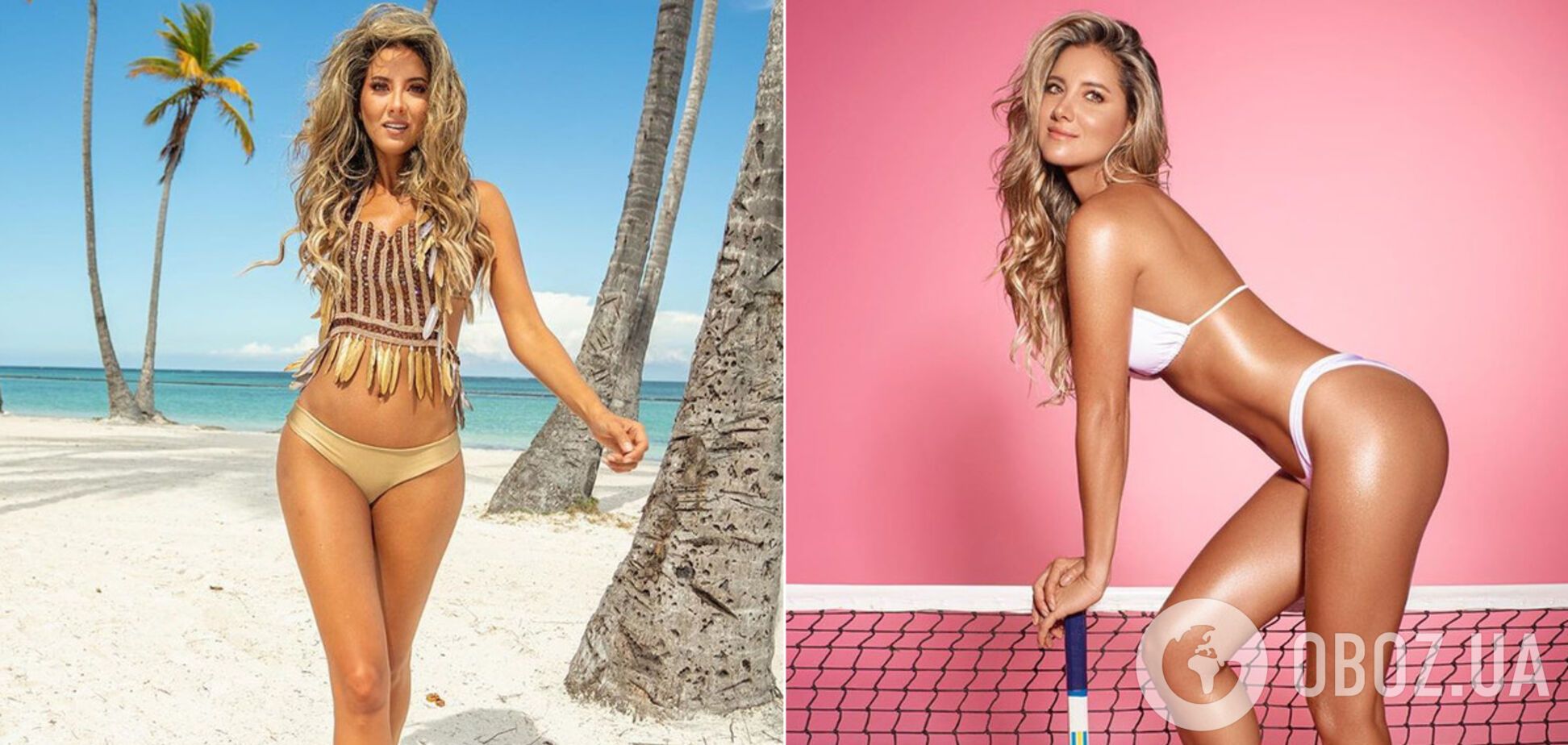 Участнице 'Мисс Вселенная' ампутировали ногу: как выглядела девушка до операции. Фото