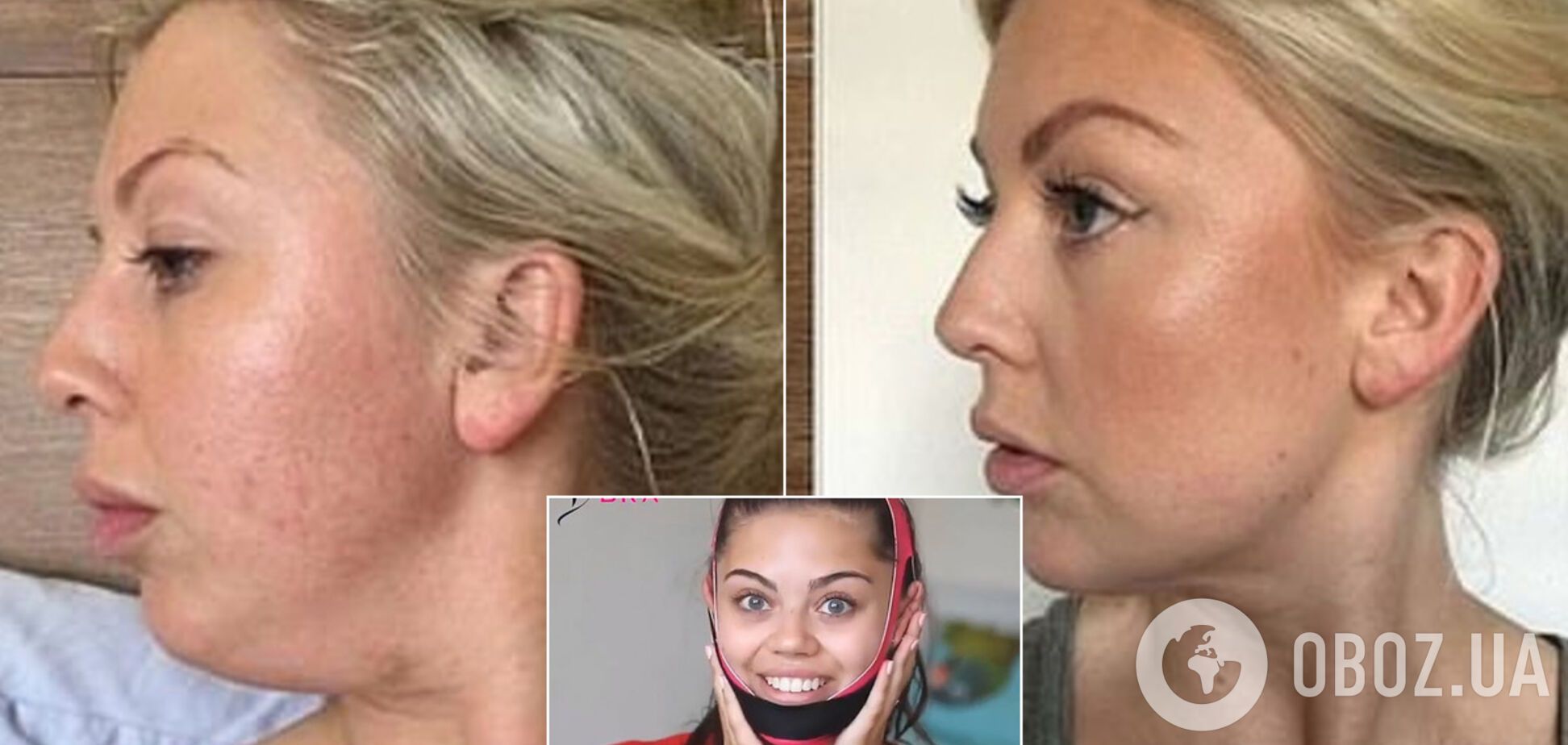 Сеть покорил 'бюстгальтер' для лица, который помогает выглядеть худее. Фото