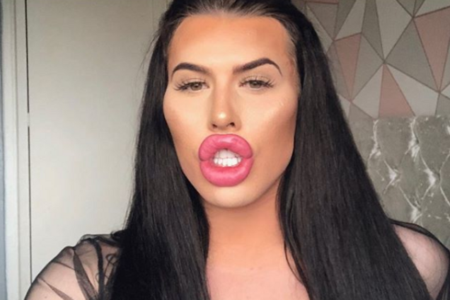 Жінка з величезними губами зізналася, як заробляє на чоловіках