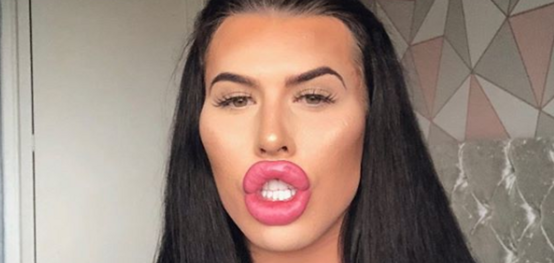 Жінка з величезними губами зізналася, як заробляє на чоловіках