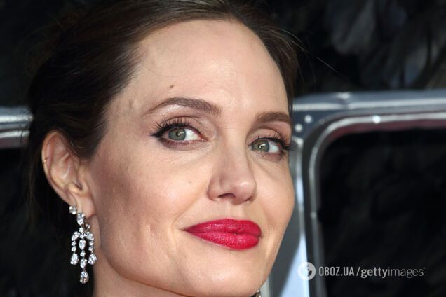 'Губы дьявола' и 'углы Джоли': пластический хирург раскрыл предпочтения украинок