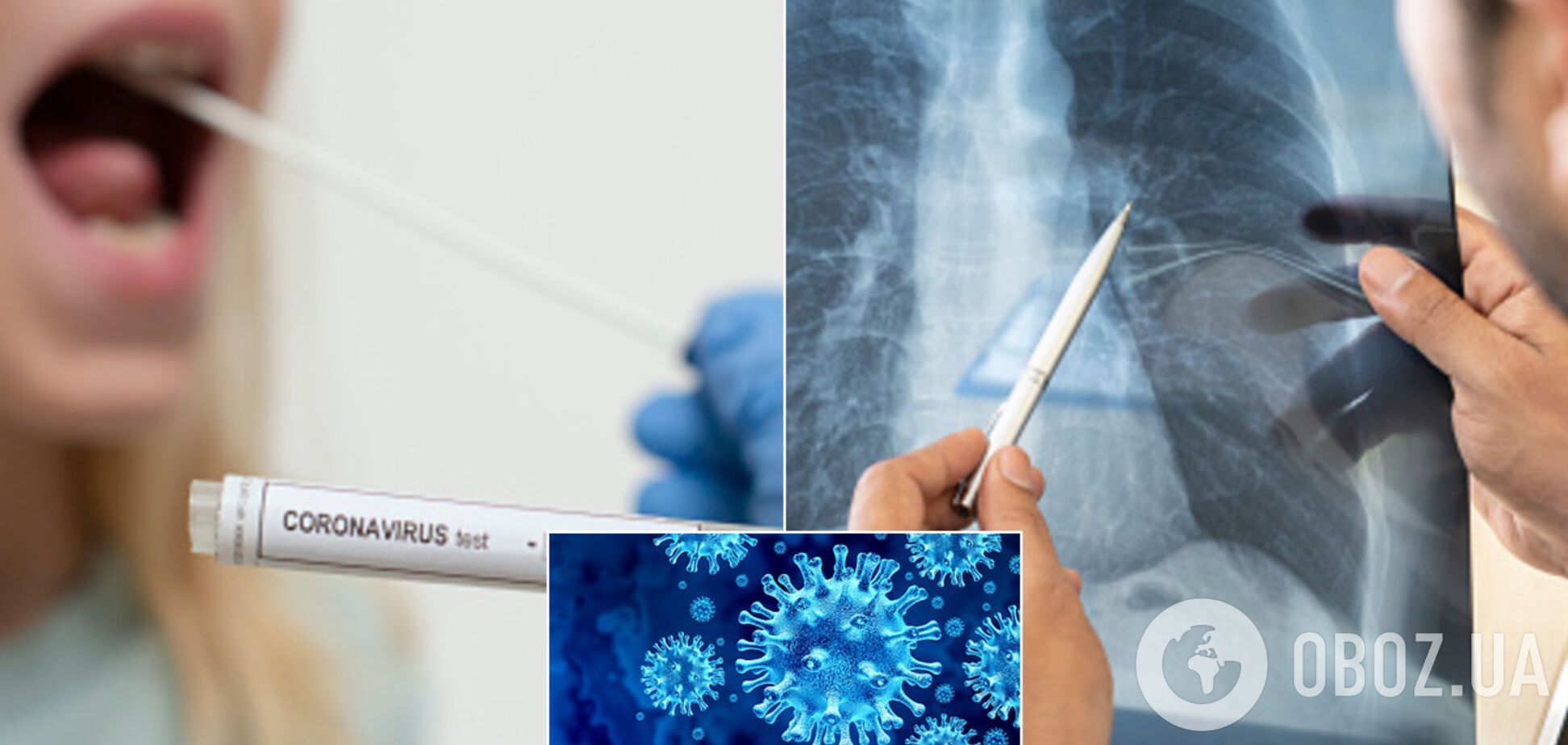 Коронавірус в Україні та світі